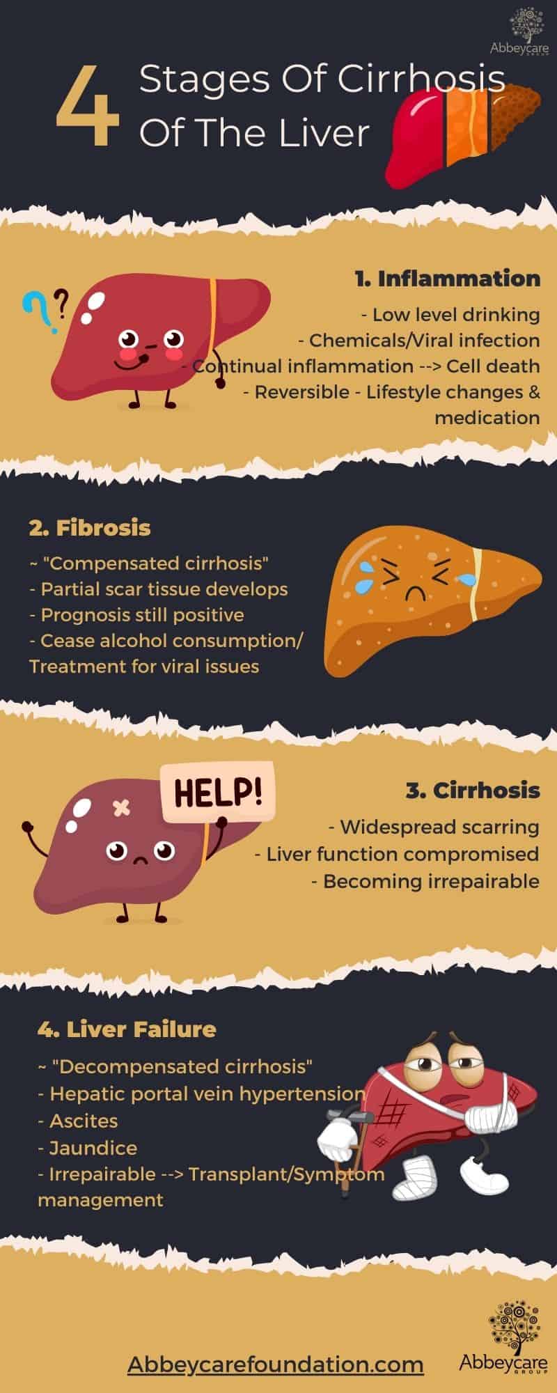 What Are The Four Stages Of Cirrhosis Of The Liver Abbeycare | My XXX ...
